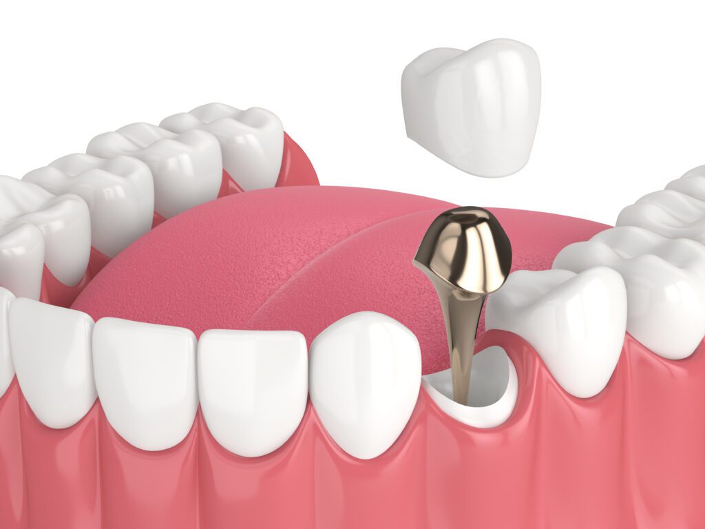 Sandi E. Silva, DDS -